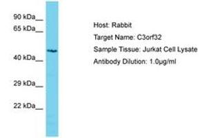 Image no. 1 for anti-Ssu-2 Homolog (C. Elegans) (SSUH2) (AA 184-233) antibody (ABIN6750606) (SSUH2 antibody  (AA 184-233))