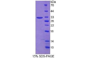 Image no. 1 for Leucine Rich Repeats And Death Domain Containing Protein (AA 666-915) protein (His tag) (ABIN4989367) (Leucine Rich Repeats And Death Domain Containing Protein (AA 666-915) protein (His tag))