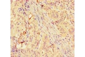 Immunohistochemistry of paraffin-embedded human adrenal gland tissue using ABIN7158878 at dilution of 1:100 (MMP12 antibody  (AA 109-470))