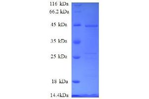 Vesicular, Overexpressed in Cancer, Prosurvival Protein 1 (VOPP1) (AA 23-172), (full length) protein (GST tag)