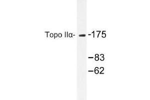 Image no. 1 for anti-Topoisomerase (DNA) II alpha 170kDa (TOP2A) antibody (ABIN317805)