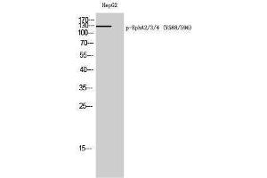 Western Blotting (WB) image for anti-EPH Receptor A2/3/4 (EPHA2/3/4) (pTyr588), (pTyr596) antibody (ABIN3182438) (EPHA2/3/4 antibody  (pTyr588, pTyr596))