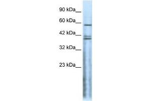 Western Blot showing CHRND antibody used at a concentration of 1-2 ug/ml to detect its target protein. (CHRND antibody  (N-Term))