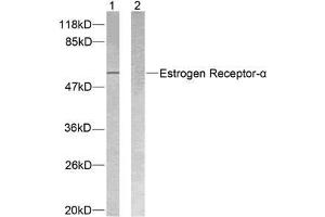 Western blot analysis of extracts from MCF7 cells using Estrogen Receptor-α (Ab-118) antibody (E021067). (Estrogen Receptor alpha antibody)