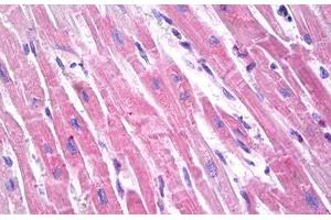 Anti-Brain Natriuretic Peptide 32 antibody IHC staining of human heart. (BNP32 antibody)