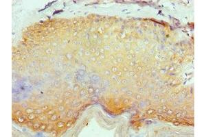 Immunohistochemistry of paraffin-embedded human skin tissue using ABIN7158251 at dilution of 1:100 (SERPINB1 antibody  (AA 100-379))