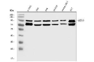 Western blot analysis of BBS9 using anti-BBS9 antibody (ABIN7601518). (BBS9 antibody  (AA 37-793))