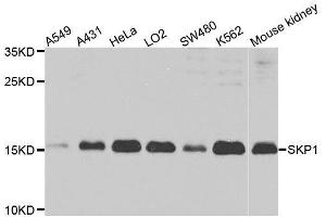 Western blot analysis of extracts of various cell lines, using SKP1 antibody.