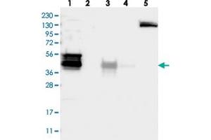 Western blot analysis of Lane 1: RT-4, Lane 2: U-251 MG, Lane 3: Human Plasma, Lane 4: Liver, Lane 5: Tonsil with WDR31 polyclonal antibody  at 1:250-1:500 dilution. (WDR31 antibody)