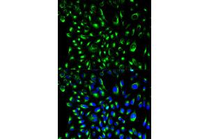 Immunofluorescence analysis of HeLa cells using LCP2 antibody (ABIN6292589). (LCP2 antibody)