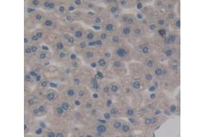 Used in DAB staining on fromalin fixed paraffin- embedded Kidney tissue (HDC antibody  (AA 341-597))