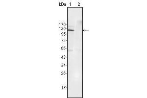 Western Blot showing EphB4 antibody used against Jurkat (1) and HEK293 (2) cell lysate. (EPH Receptor B4 antibody  (AA 562-612))