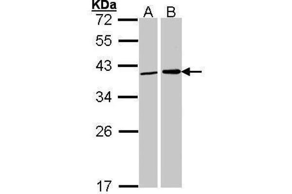 Fibrillarin antibody