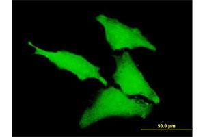 Immunofluorescence of purified MaxPab antibody to CLIC1 on HeLa cell. (CLIC1 antibody  (AA 1-241))