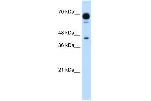 PUS7 antibody used at 1. (PUS7 antibody)