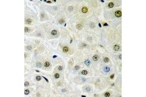 Immunohistochemical analysis of Dysbindin 1 staining in rat liver  formalin fixed paraffin embedded tissue section. (DTNBP1 antibody)
