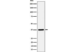 Western blot analysis of Syntaxin 16 expression in HeLa cell lysate. (Recombinant Syntaxin 16 antibody)