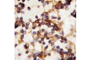 Formalin-fixed and paraffin-embedded human Lymph tissue reacted with Rictor antibody (N-term) , which was peroxidase-conjugated to the secondary antibody, followed by DAB staining. (RICTOR antibody  (N-Term))