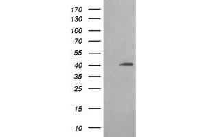 Western Blotting (WB) image for anti-Acetyl-CoA Acyltransferase 2 (ACAA2) antibody (ABIN1495727) (ACAA2 antibody)