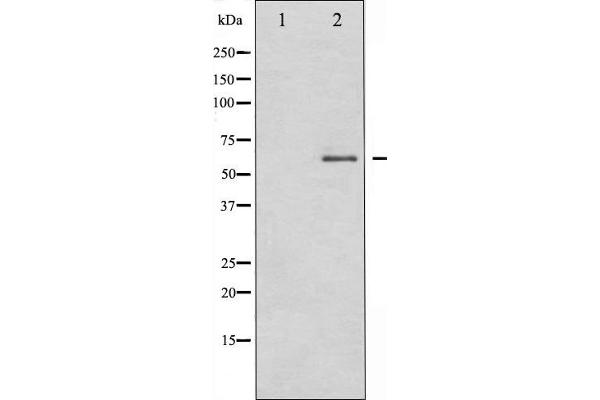 DPYSL2 antibody  (C-Term)