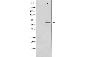 Western blot analysis of DRP-2 expression in EGF treated A549 whole cell lysates,The lane on the left is treated with the antigen-specific peptide. (DPYSL2 antibody  (C-Term))
