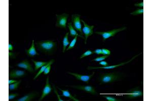 Immunofluorescence of purified MaxPab antibody to ULK4 on HeLa cell. (ULK4 antibody  (AA 1-580))