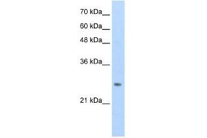 WB Suggested Anti-HOXB7 Antibody Titration:  0. (HOXB7 antibody  (C-Term))