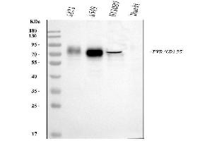 Western blot analysis of Poliovirus Receptor/PVR using anti-Poliovirus Receptor/PVR antibody (ABIN7601071).