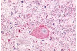 Anti-NTSR1 antibody  ABIN1049155 IHC staining of human brain, neurons and glia.