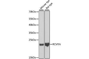 Western blot analysis of extracts of various cell lines, using RCVRN antibody. (Recoverin antibody)