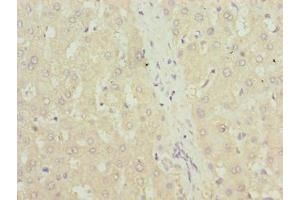 Immunohistochemistry of paraffin-embedded human liver tissue using ABIN7172018 at dilution of 1:100 (TXNRD1 antibody  (AA 1-497))
