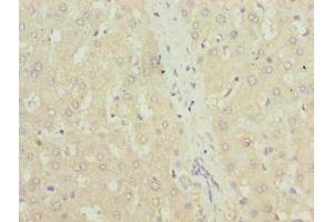 Immunohistochemistry of paraffin-embedded human liver tissue using ABIN7172018 at dilution of 1:100