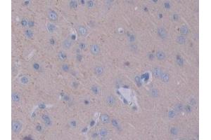 Detection of STAM1 in Rat Cerebrum Tissue using Polyclonal Antibody to Signal Transducing Adaptor Molecule 1 (STAM1)