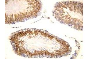 FGF8 Polyclonal Antibody (FGF8 antibody  (C-Term))