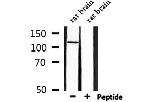 Western blot analysis of extracts from rat brain, using GRIA4 Antibody. (GRIA4 antibody)