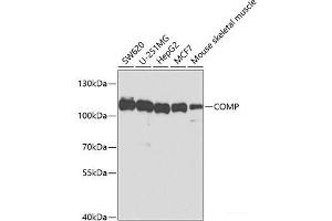 Western blot analysis of extracts of various cell lines using COMP Polyclonal Antibody at dilution of 1:1000.