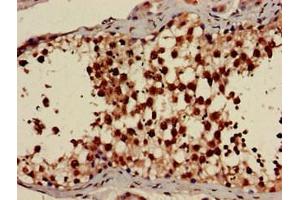 Immunohistochemistry of paraffin-embedded human testis tissue using ABIN7142682 at dilution of 1:100 (PRKAG1 antibody  (AA 1-331))