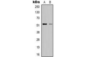 Western blot analysis of RSAD1 expression in HepG2 (A), Hela (B) whole cell lysates. (RSAD1 antibody)