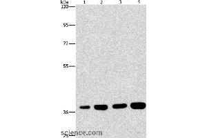 Western blot analysis of 293T and 231 cell, U937 and Raji cell, using SERPINA9 Polyclonal Antibody at dilution of 1:337.