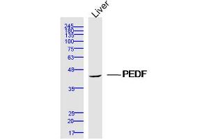 Mouse Liver lysates probed with PEDF Polyclonal Antibody, Unconjugated  at 1:300 dilution and 4˚C overnight incubation. (PEDF antibody  (AA 101-200))