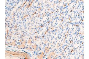 ABIN6267068 at 1/100 staining rat gastric tissue sections by IHC-P. (Smooth Muscle Actin antibody  (N-Term))