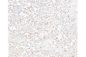 anti-General Transcription Factor 3C Polypeptide 3 (GTF3C3) (AA 475-525) antibody