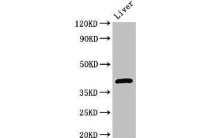 Western Blot Positive WB detected in: Mouse liver tissue All lanes: GNAT1 antibody at 3 μg/mL Secondary Goat polyclonal to rabbit IgG at 1/50000 dilution Predicted band size: 41 kDa Observed band size: 41 kDa (GNAT1 antibody  (AA 92-170))