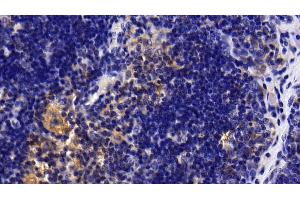 Detection of IL1R1 in Rat Thymus Tissue using Polyclonal Antibody to Interleukin 1 Receptor Type I (IL1R1) (IL1R1 antibody  (AA 226-352))