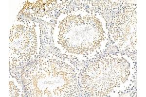 ABIN7094849 and ABIN7098900 at 1/100 staining Rat testis tissue by IHC-P.