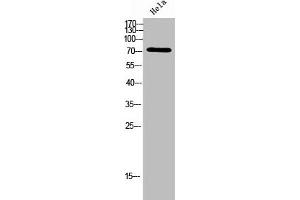 Western Blot analysis of Hela cells using ACSVL6 Polyclonal Antibody (SLC27A5 antibody  (Internal Region))