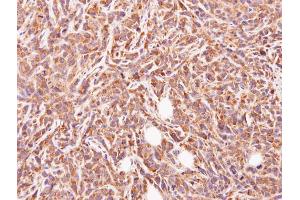 IHC-P Image Immunohistochemical analysis of paraffin-embedded SAS xenograft, using GLYATL1, antibody at 1:500 dilution. (GLYATL1 antibody)