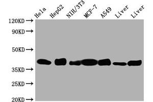 Western Blot Positive WB detected in: Hela whole cell lysate, HepG2 whole cell lysate, NIH/3T3 whole cell lysate, A549 whole cell lysate, Mouse Liver whole cell lysate, Rat Liver whole cell lysate All lanes: Aldolase antibody at 1:1000 Secondary Goat polyclonal to rabbit IgG at 1/50000 dilution Predicted band size: 40, 46 kDa Observed band size: 40 kDa (Recombinant ALDOA antibody)
