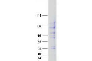Validation with Western Blot (TGFBR2 Protein (Transcript Variant 2) (Myc-DYKDDDDK Tag))