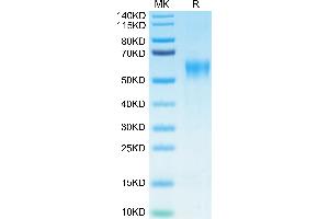 Biotinylated Human IL-15RA on Tris-Bis PAGE under reduced condition. (IL15RA Protein (His-Avi Tag,Biotin))